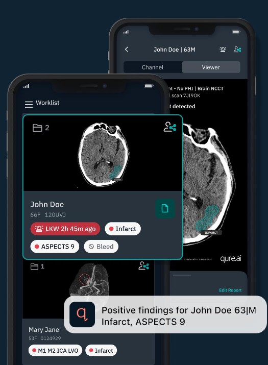 Qure.ai qER: lista priorizada y visor de TC craneal en la estacion de trabajo