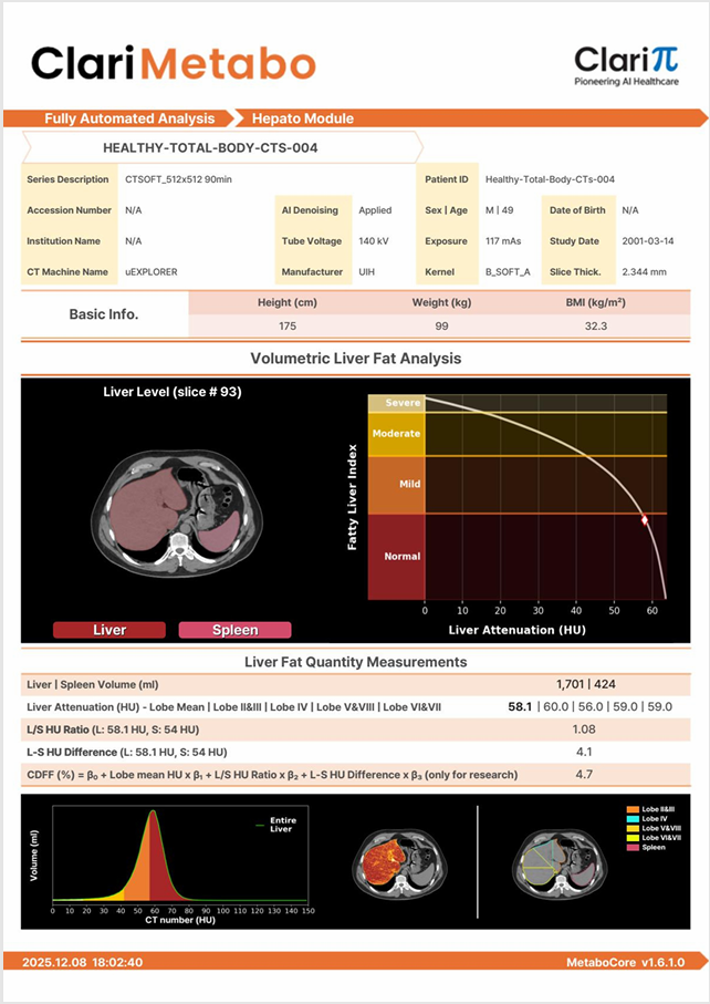 Informe ClariMetabo, modulo Hepato