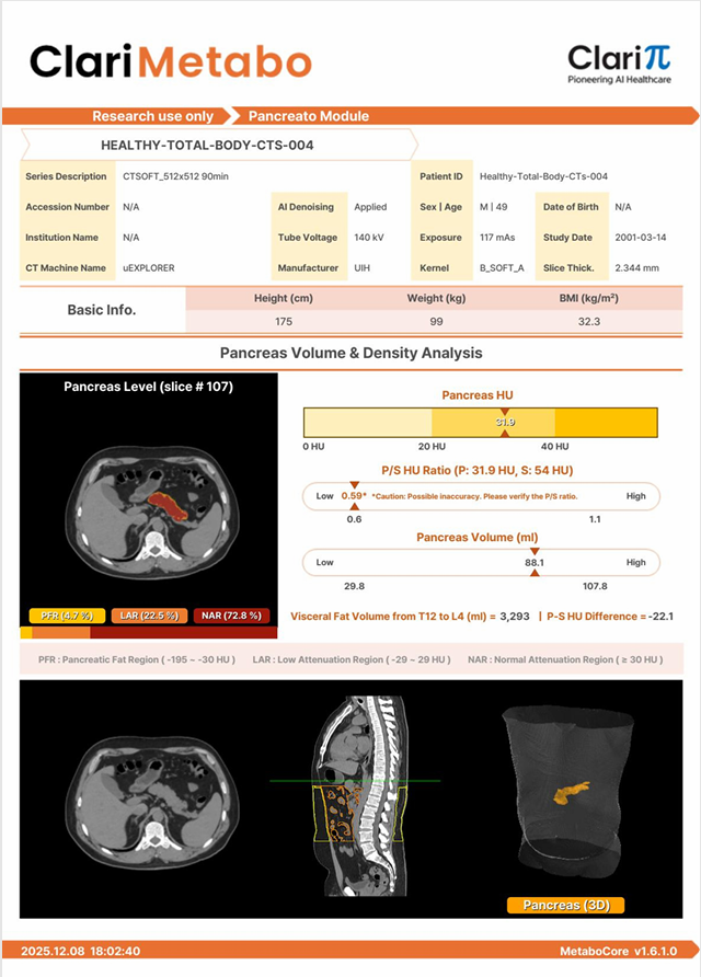 Informe ClariMetabo, modulo Pancreato