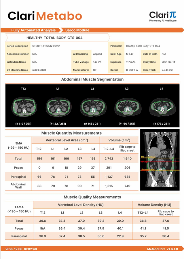 Informe ClariMetabo, modulo Sarco
